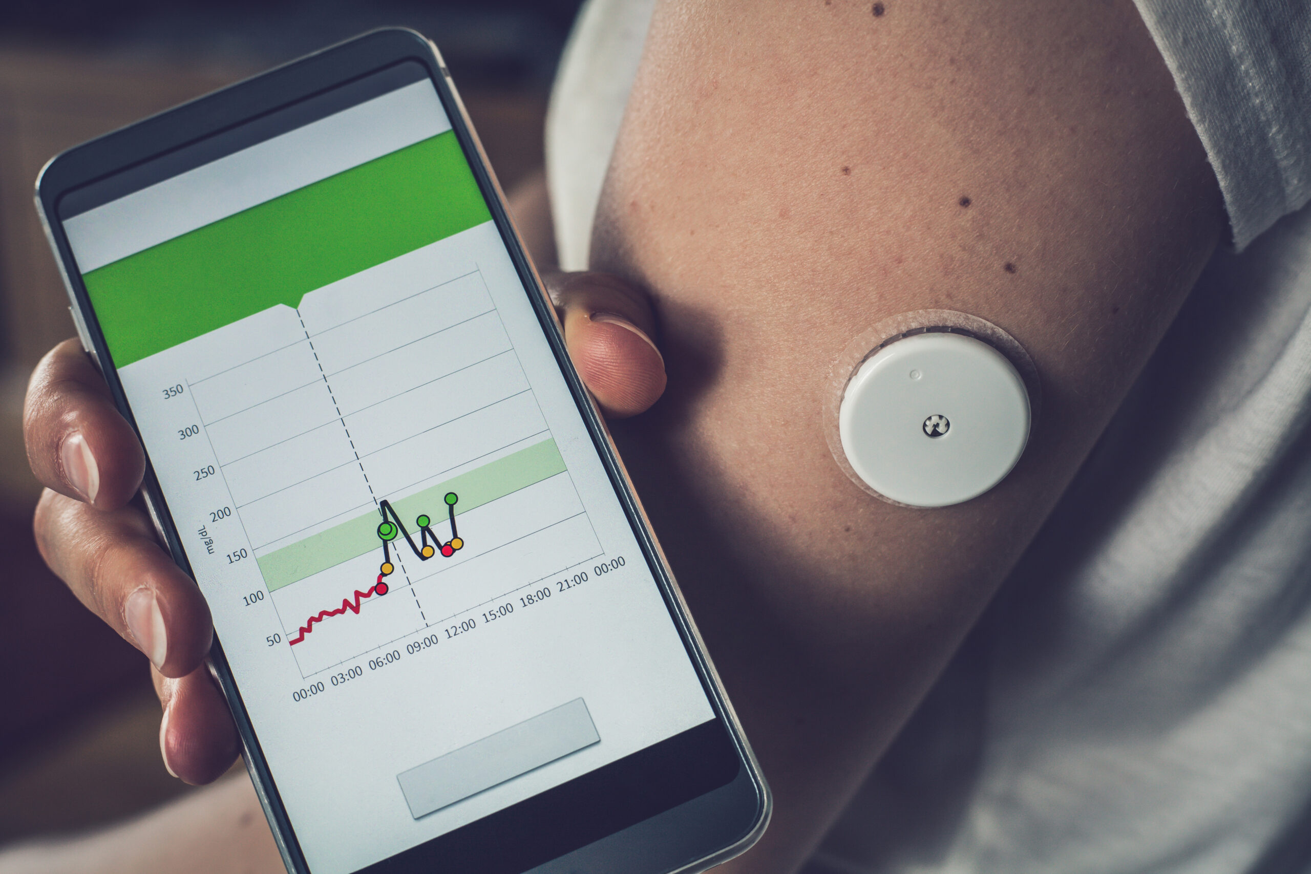 Continuous glucose monitor sensor on arm with smartphone app displaying blood glucose levels over 24 hours